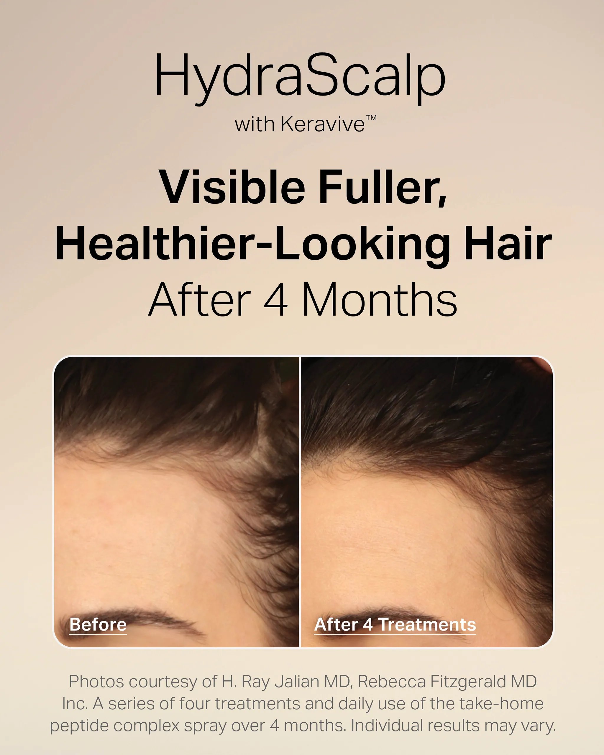Scalp Analysis Consultation before and after