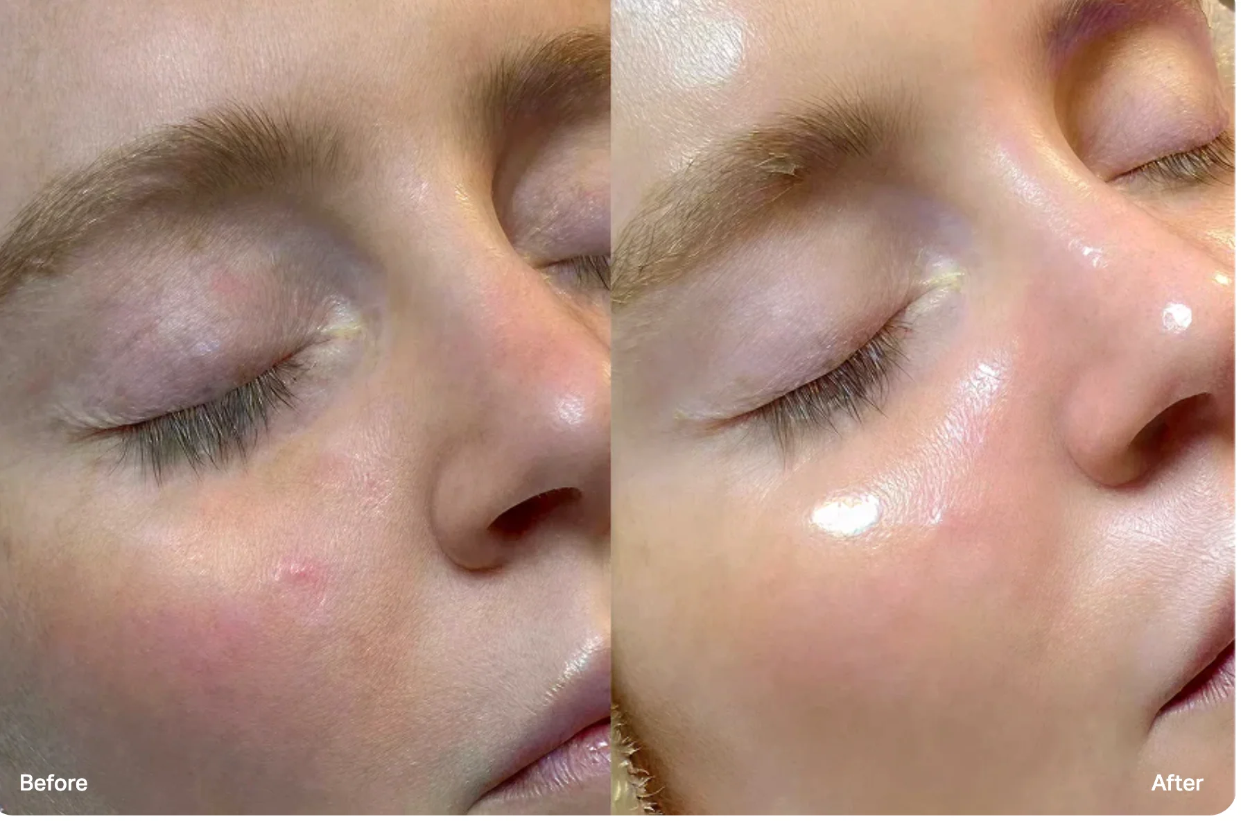 Minori Signature Facial before and after